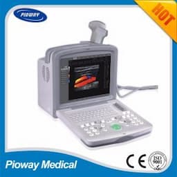 128 Element Portable 3D Color Doppler Ultrasound Machine (FDC6000)