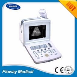 Portable Ultrasound Scanner (PW-9618)