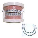 Hot Selling Dental Products USA Beauty Equipments Odontologia Brackets Ortodoncia Fashion Fake Braces for Teeth