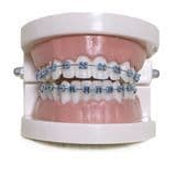 New 2024 Products Dental Beauty Equipment Fashion Fake Braces for Teeth