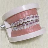 New Arrival Dental Beauty Equipments Brackets Products Odontologia Fashion Fake Braces for Teeth