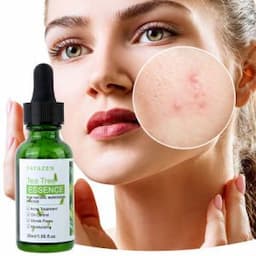 Anti-Acne Reduces Redness Hydrating Smoothing Skin Tea Tree Facial Moisturizing Essence